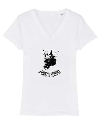 Anorexia nervosa White